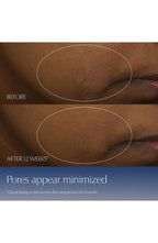Advanced Night Repair Synchronized Multi-Recovery Complex Serum with Hyaluronic Acid & Peptides-1.7oz