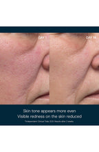 Dynamic Resurfacing Facial Pads-14count