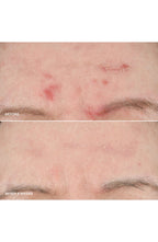 Vitamin Enriched Smoothing Niacinamide + Vitamin C Serum