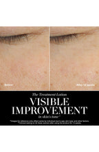 The New Treatment Lotion for Hydration & Anti-Aging
